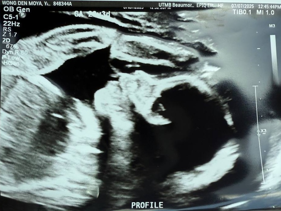 Expecting parents